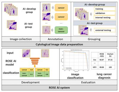 The application of artificial intelligence for Rapid On-Site Evaluation during flexible bronchoscopy
